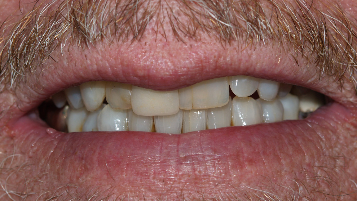 Before