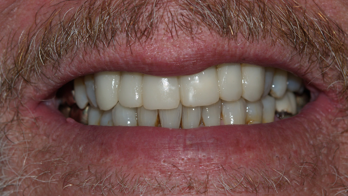 After