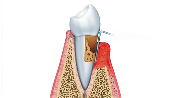 Periodontics Hickory, NC